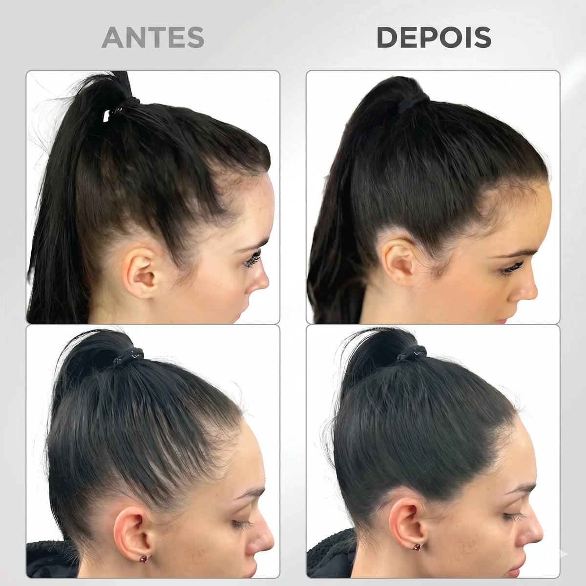 Fibra de preenchimento capilar Persya